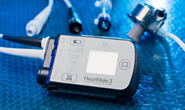 Beginner’s Guide to the LVAD